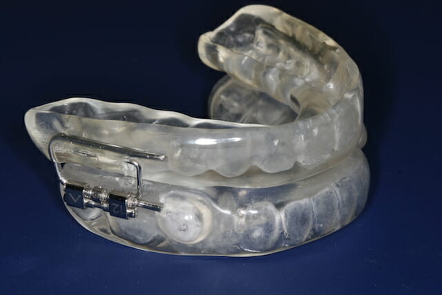 Oral Appliance Therapy