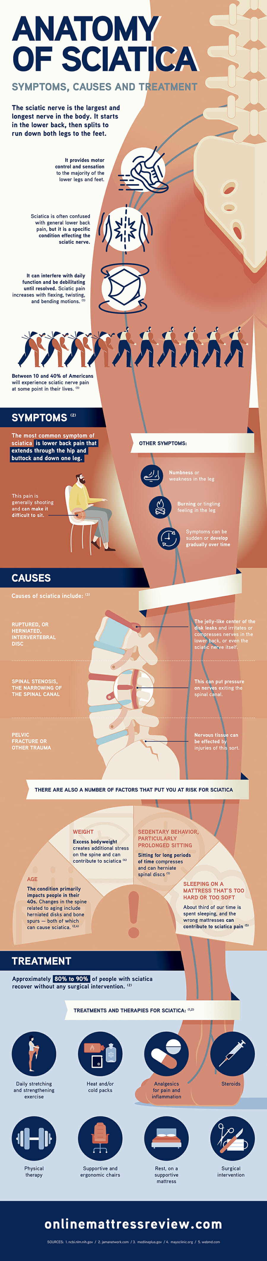 Anatomy of Sciatica