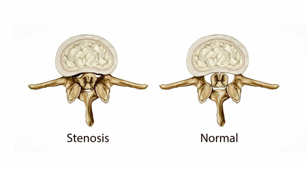 OMR FAQ LowerBackPain Body2