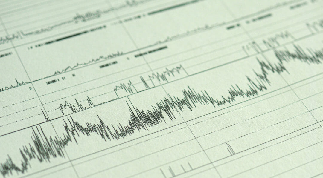 How Much Does a Sleep Study Cost? Online Mattress Review