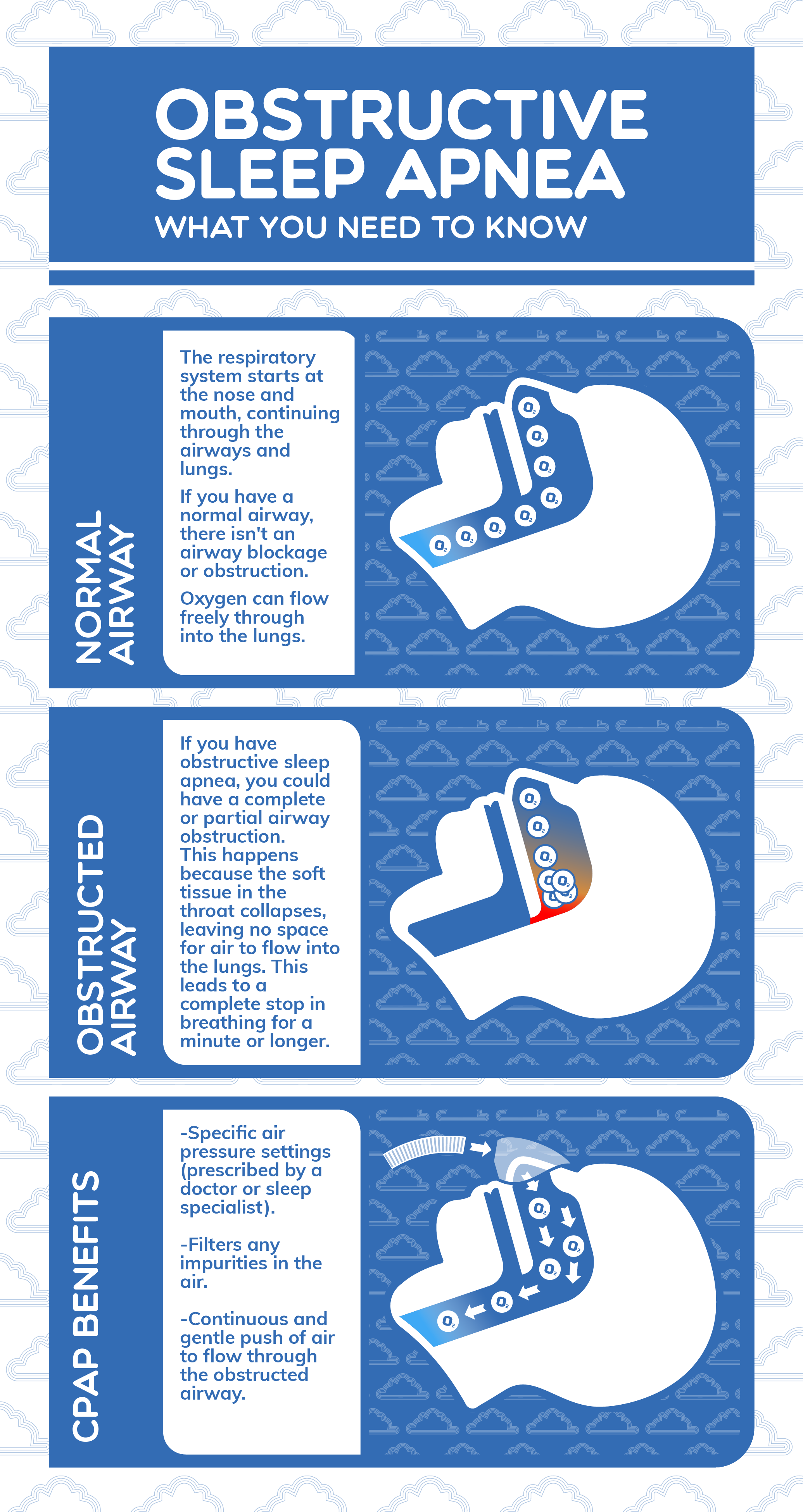 OMR SS SleepApnea Obstructive Sleep Apnea